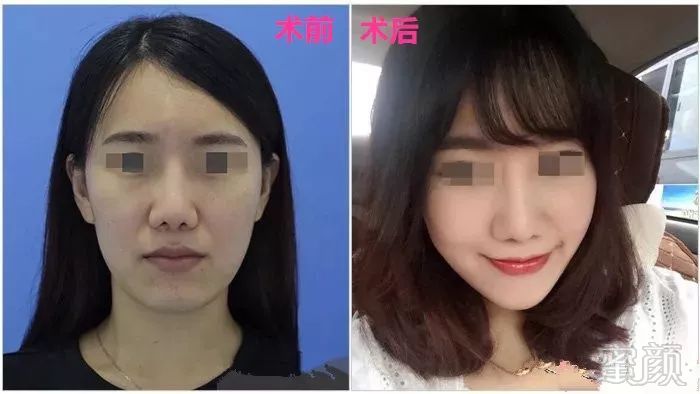 https://img.miyanlife.com/mnt/timg/190107/12122G406-7.jpg
