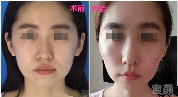 https://img.miyanlife.com/mnt/timg/190107/12122I1c-5.jpg