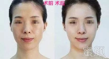 https://img.miyanlife.com/mnt/timg/190107/12122K595-6.jpg