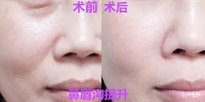 https://img.miyanlife.com/mnt/timg/190107/12122L147-2.jpg