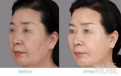 https://img.miyanlife.com/mnt/timg/190107/12122MF3-4.jpg