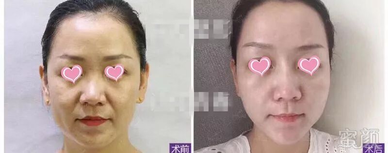 https://img.miyanlife.com/mnt/timg/190107/12122TX6-8.jpg