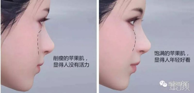 https://img.miyanlife.com/mnt/timg/190108/11445T448-1.jpg