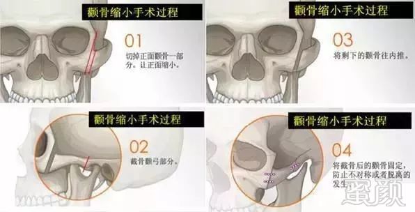 https://img.miyanlife.com/mnt/timg/190108/122045EA-5.jpg