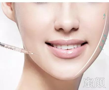 https://img.miyanlife.com/mnt/timg/190108/1250046157-0.jpg