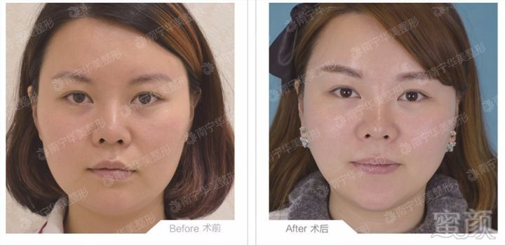 https://img.miyanlife.com/mnt/timg/190108/12500550W-5.jpg