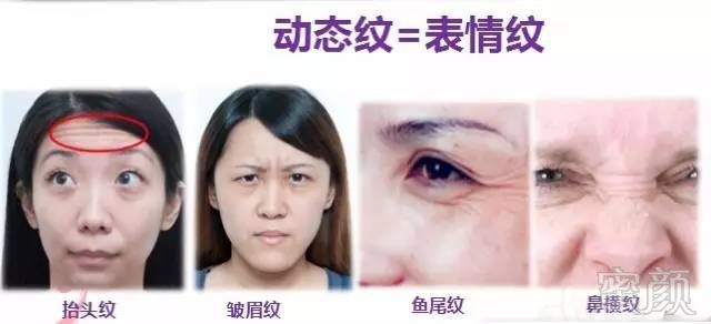 https://img.miyanlife.com/mnt/timg/190108/130Q32117-8.jpg