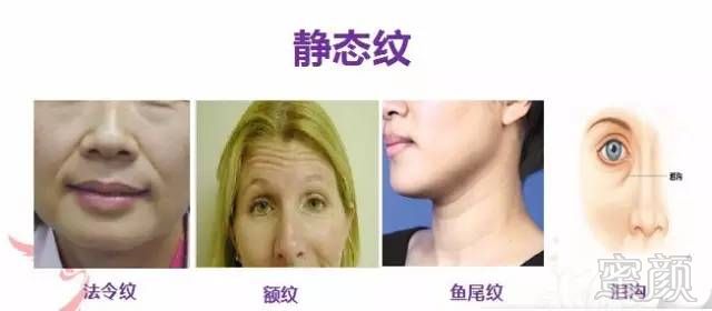 https://img.miyanlife.com/mnt/timg/190108/130Q42G1-9.jpg