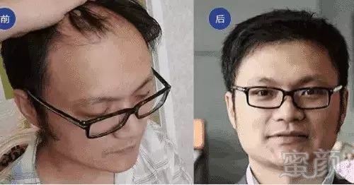https://img.miyanlife.com/mnt/timg/190109/11495L193-2.jpg