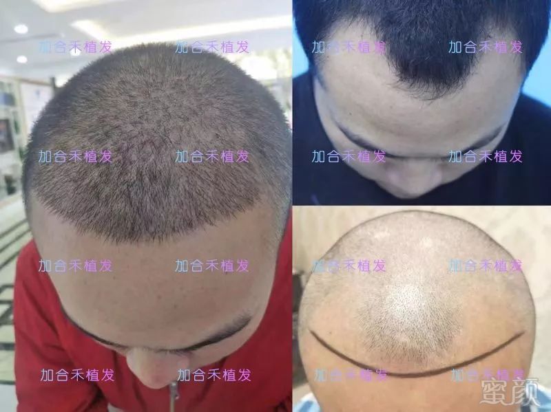 https://img.miyanlife.com/mnt/timg/190109/1204234322-6.jpg