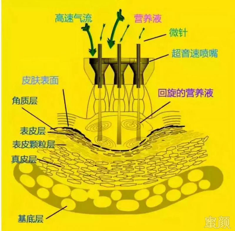 https://img.miyanlife.com/mnt/timg/190109/121502E19-0.jpg