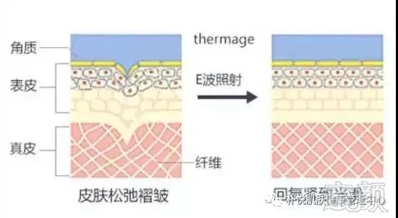 案例图片