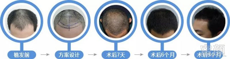 https://img.miyanlife.com/mnt/timg/190109/1224115437-0.jpg