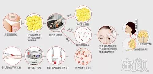 案例图片