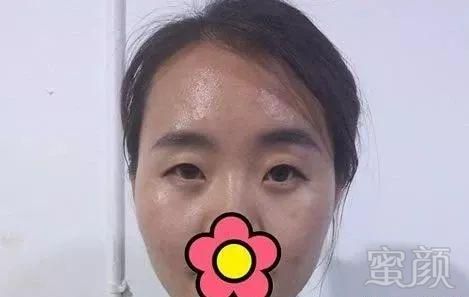 https://img.miyanlife.com/mnt/timg/190109/1400591537-0.jpg