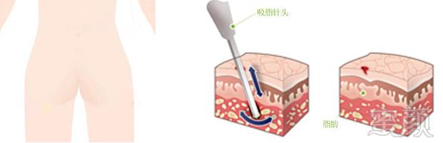 案例图片