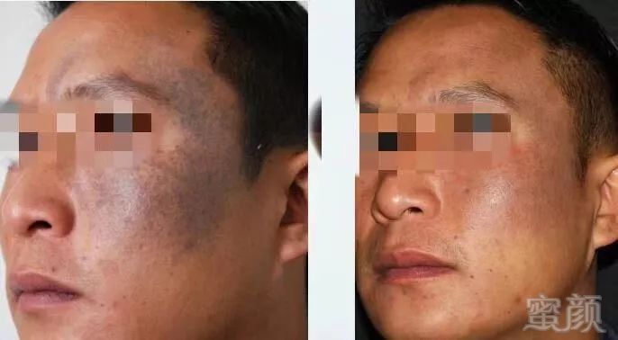 https://img.miyanlife.com/mnt/timg/190110/111R11U3-12.jpg