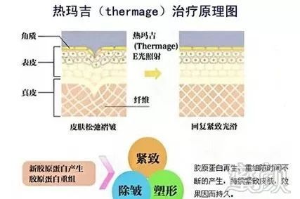 https://img.miyanlife.com/mnt/timg/190110/12291911J-6.jpg