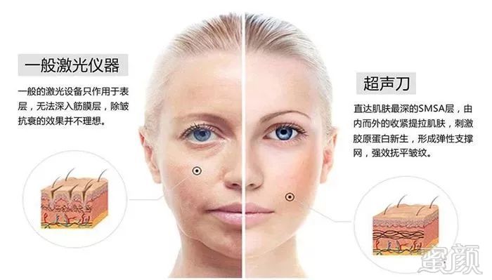 https://img.miyanlife.com/mnt/timg/190110/12291A954-2.jpg