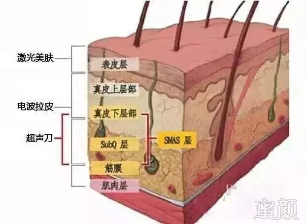 https://img.miyanlife.com/mnt/timg/190110/12291S1P-5.jpg