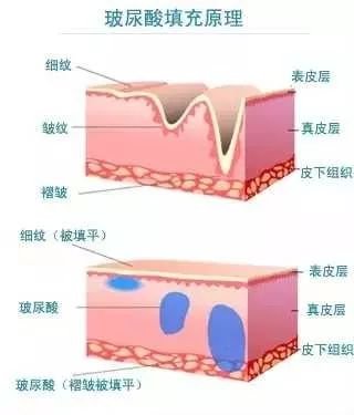 https://img.miyanlife.com/mnt/timg/190110/12395G9B-5.jpg