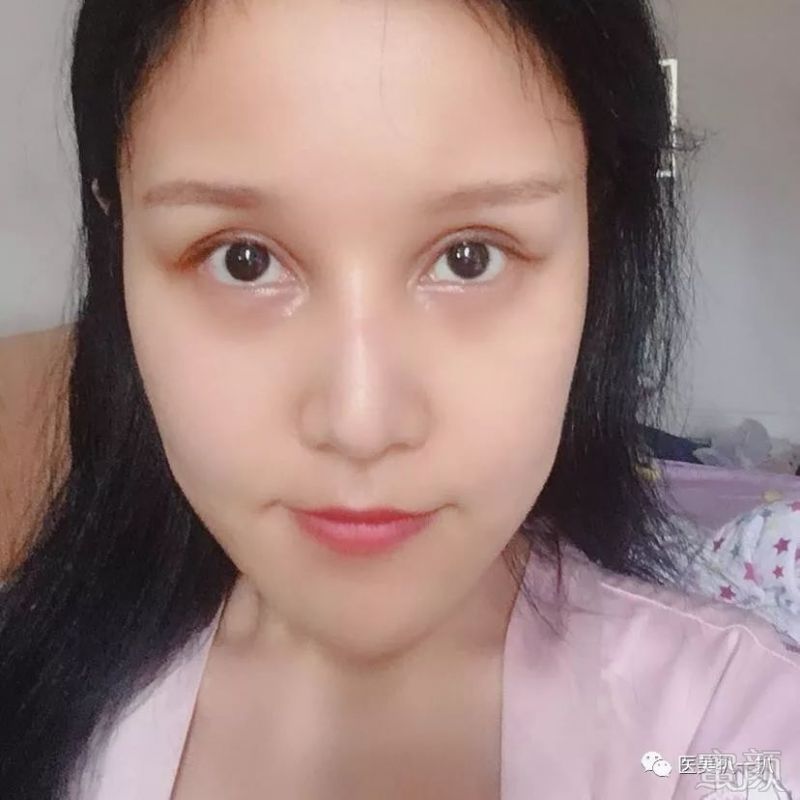 https://img.miyanlife.com/mnt/timg/190111/113PH394-1.jpg