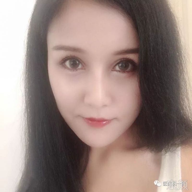 https://img.miyanlife.com/mnt/timg/190111/113PJI2-2.jpg