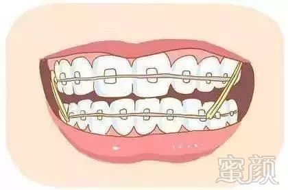 https://img.miyanlife.com/mnt/timg/190111/11400330J-11.jpg
