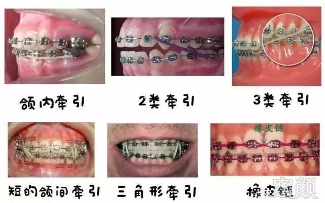 https://img.miyanlife.com/mnt/timg/190111/114003CL-13.jpg