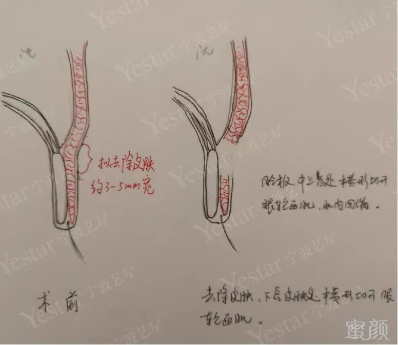 案例图片