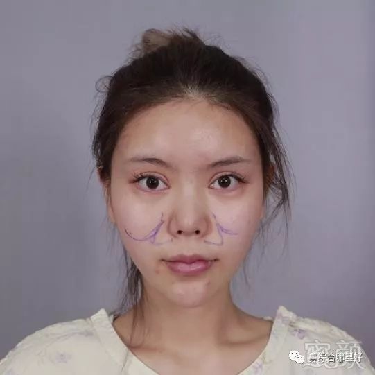 https://img.miyanlife.com/mnt/timg/190111/13025933N-0.jpg