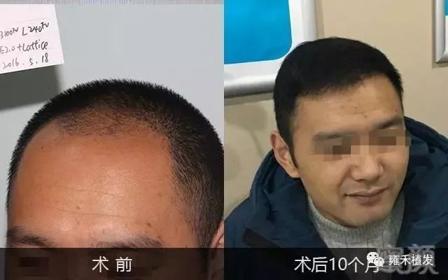 https://img.miyanlife.com/mnt/timg/190111/130Z931M-9.jpg