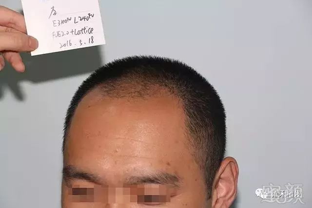 https://img.miyanlife.com/mnt/timg/190111/130ZJ5U-1.jpg