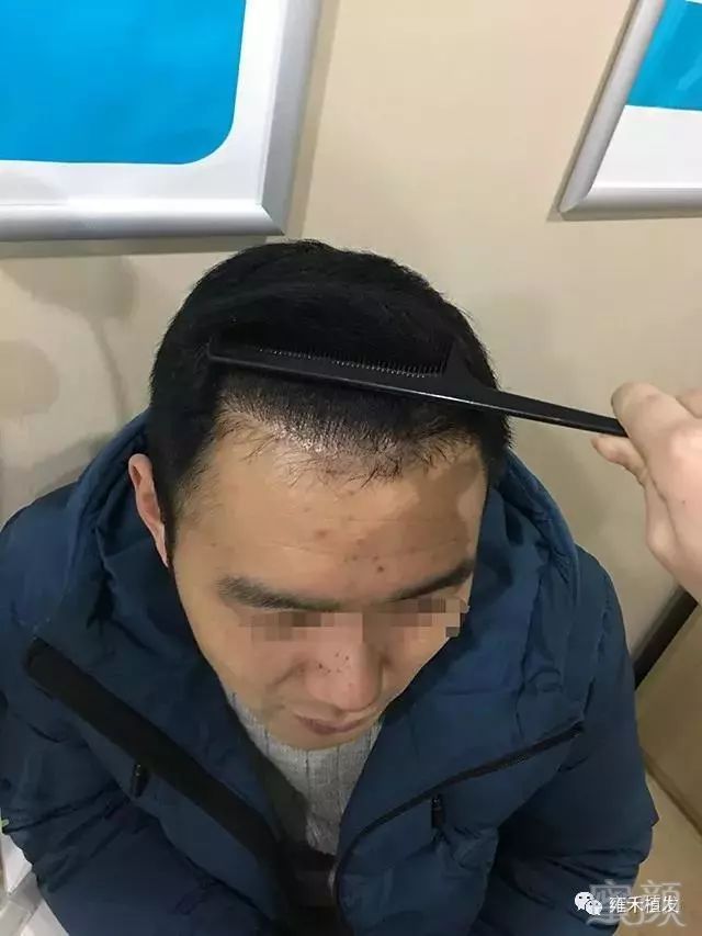 https://img.miyanlife.com/mnt/timg/190111/130ZR225-6.jpg