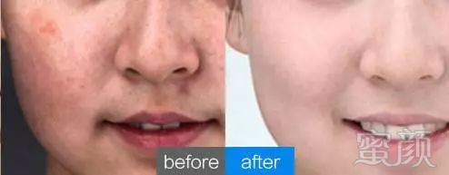 https://img.miyanlife.com/mnt/timg/190111/1315244P4-5.jpg