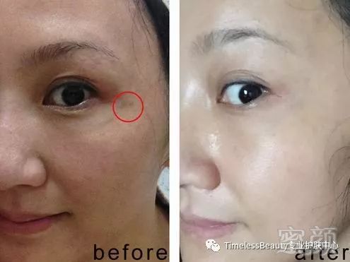 https://img.miyanlife.com/mnt/timg/190111/1316213214-3.jpg