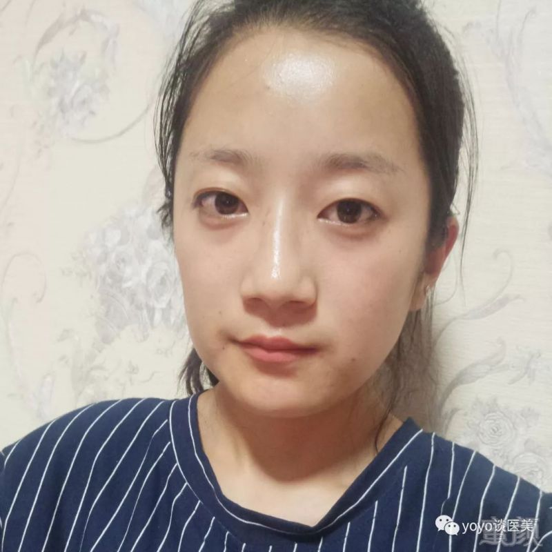 https://img.miyanlife.com/mnt/timg/190112/1251433a5-0.jpg