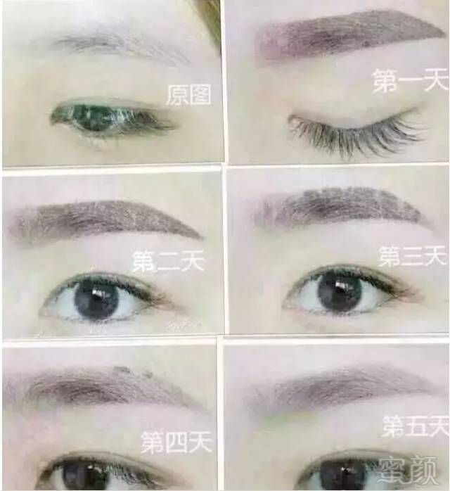 案例图片