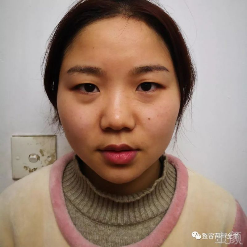 https://img.miyanlife.com/mnt/timg/190112/13353M131-1.jpg