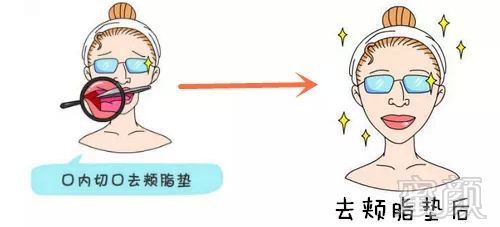https://img.miyanlife.com/mnt/timg/190112/133G13T8-3.jpg