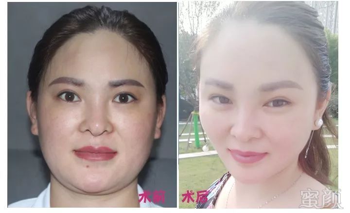 https://img.miyanlife.com/mnt/timg/190112/133G2O10-6.jpg