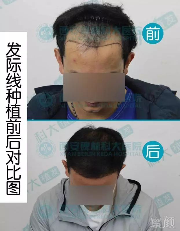 https://img.miyanlife.com/mnt/timg/190112/13453622C-1.jpg