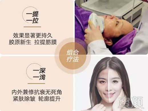 https://img.miyanlife.com/mnt/timg/190113/110P125V-2.jpg
