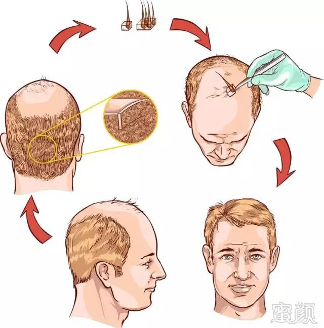 https://img.miyanlife.com/mnt/timg/190113/11251RC3-6.jpg