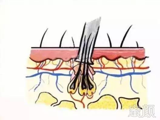 案例图片