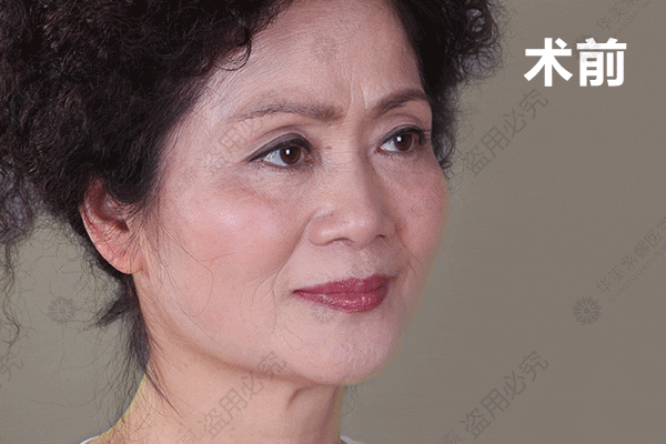 https://img.miyanlife.com/mnt/timg/190113/113215C61-10.gif