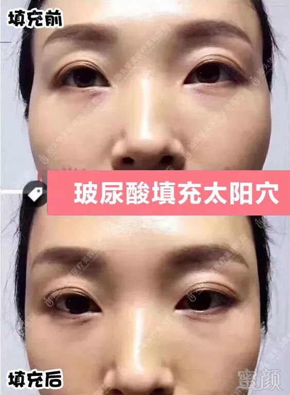 https://img.miyanlife.com/mnt/timg/190113/115U3D00-1.jpg