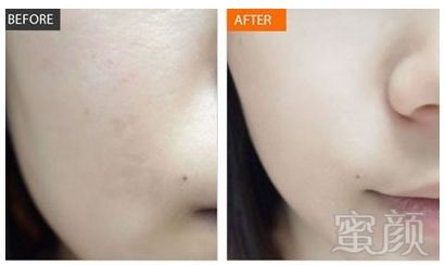https://img.miyanlife.com/mnt/timg/190114/1102141144-8.jpg