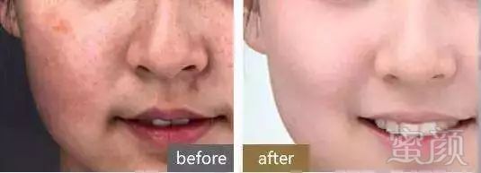 https://img.miyanlife.com/mnt/timg/190114/1102142250-10.jpg