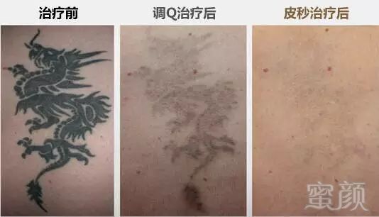 https://img.miyanlife.com/mnt/timg/190114/11021442Z-11.jpg